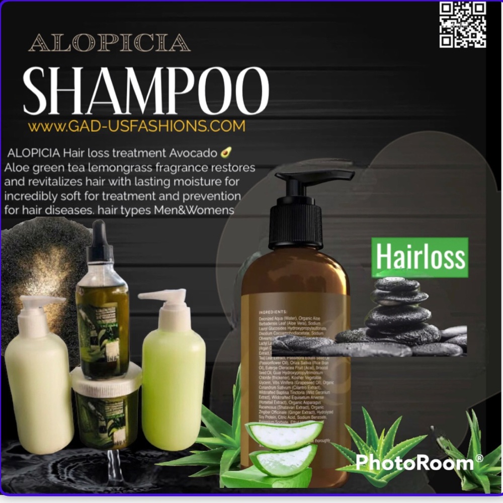 Best Alopicia Hairloss Treatment